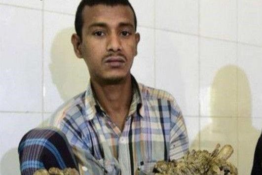 人身上还能够长出树枝？这名男子就是如此！ 